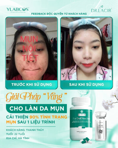 phản hồi viên uống mụn dr lacir